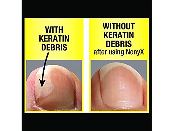 NONYX NAIL GEL 4OZ